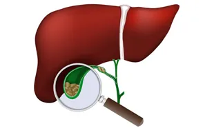 Hepatobiliary Surgeon