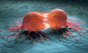Oncologist
